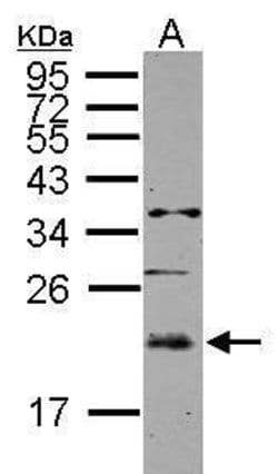 Invitrogen UBE2E3 Polyclonal Antibody 100 &mu;L; Unconjugated:Antibodies,