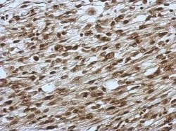 Invitrogen SLU7 Polyclonal Antibody 100 &mu;L; Unconjugated:Antibodies,