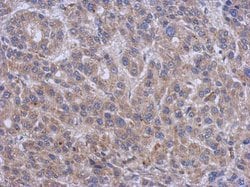 Invitrogen SPTLC2 Polyclonal Antibody 100 &mu;L; Unconjugated:Antibodies,