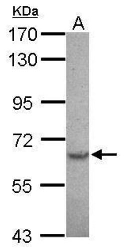 Invitrogen SPTLC2 Polyclonal Antibody 100 &mu;L; Unconjugated:Antibodies,