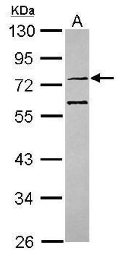 Invitrogen CMG1 Polyclonal Antibody 100 &mu;L; Unconjugated:Antibodies,