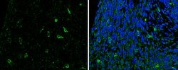 Invitrogen&trade;&nbsp;SLIT2 Polyclonal Antibody