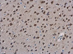 Invitrogen SLIT2 Polyclonal Antibody 100 &mu;L | Buy Online | Invitrogen&trade; | Fisher Scientific