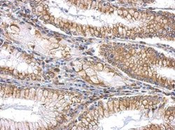 Invitrogen SLIT2 Polyclonal Antibody 100 &mu;L | Buy Online | Invitrogen&trade; | Fisher Scientific