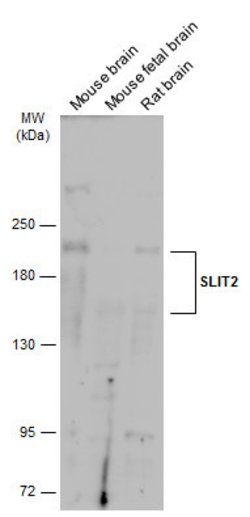 Invitrogen SLIT2 Polyclonal Antibody 100 &mu;L | Buy Online | Invitrogen&trade; | Fisher Scientific
