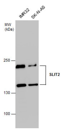 Invitrogen SLIT2 Polyclonal Antibody 100 &mu;L | Buy Online | Invitrogen&trade; | Fisher Scientific
