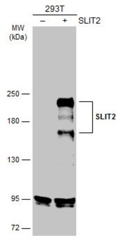 Invitrogen SLIT2 Polyclonal Antibody 100 &mu;L | Buy Online | Invitrogen&trade; | Fisher Scientific