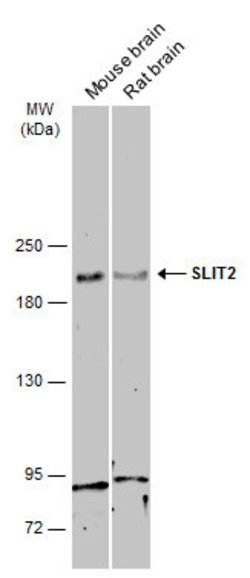 Invitrogen SLIT2 Polyclonal Antibody 100 &mu;L | Buy Online | Invitrogen&trade; | Fisher Scientific