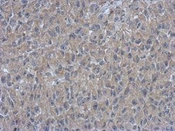 Invitrogen ARMC1 Polyclonal Antibody 100 &mu;L; Unconjugated:Antibodies,
