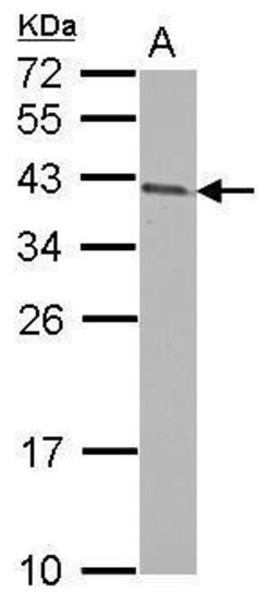 Invitrogen ARMC1 Polyclonal Antibody 100 &mu;L; Unconjugated:Antibodies,
