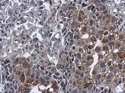Invitrogen Mig-6 Polyclonal Antibody 100 μL; Unconjugated:Antibodies,