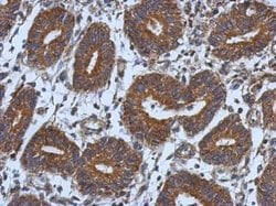Invitrogen CNOT7 Polyclonal Antibody 100 &mu;L; Unconjugated:Antibodies,