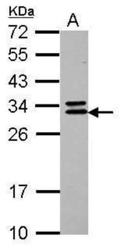 Invitrogen CNOT7 Polyclonal Antibody 100 &mu;L; Unconjugated:Antibodies,
