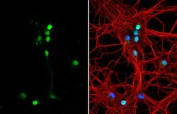 Tenascin R Polyclonal Antibody, Invitrogen 100 &mu;L; Unconjugated:Antibodies,