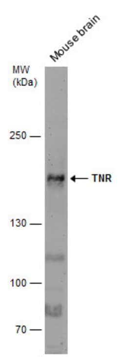 Tenascin R Polyclonal Antibody, Invitrogen 100 &mu;L; Unconjugated:Antibodies,