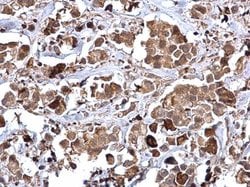 Invitrogen RAD51 Polyclonal Antibody 100 &mu;L; Unconjugated:Antibodies,