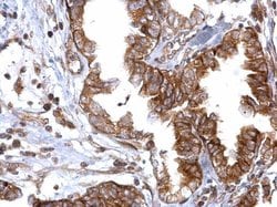 Invitrogen RAD51 Polyclonal Antibody 100 &mu;L; Unconjugated:Antibodies,