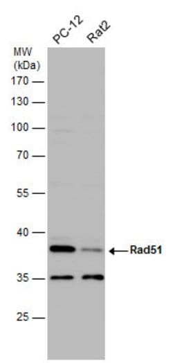 Invitrogen RAD51 Polyclonal Antibody 100 &mu;L; Unconjugated:Antibodies,