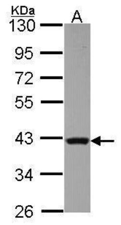 Invitrogen RAD51 Polyclonal Antibody 100 &mu;L; Unconjugated:Antibodies,
