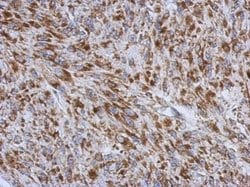 Invitrogen RNF212 Polyclonal Antibody 100 &mu;L; Unconjugated:Antibodies,