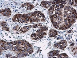 Invitrogen RNF212 Polyclonal Antibody 100 &mu;L; Unconjugated:Antibodies,
