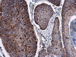 Invitrogen RNF212 Polyclonal Antibody 100 &mu;L; Unconjugated:Antibodies,