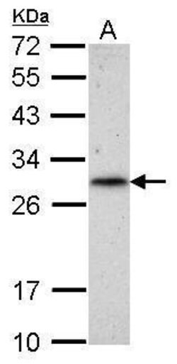 Invitrogen RNF212 Polyclonal Antibody 100 &mu;L; Unconjugated:Antibodies,