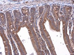 Invitrogen RAB39B Polyclonal Antibody 100 &mu;L; Unconjugated:Antibodies,