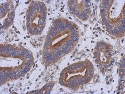 Invitrogen RAB39B Polyclonal Antibody 100 &mu;L; Unconjugated:Antibodies,
