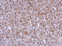 Invitrogen RAB39B Polyclonal Antibody 100 &mu;L; Unconjugated:Antibodies,