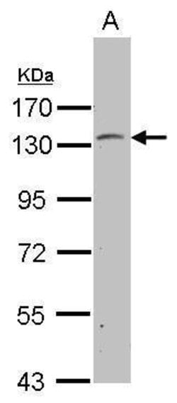 Invitrogen PSD Polyclonal Antibody 100 &mu;L; Unconjugated:Antibodies,