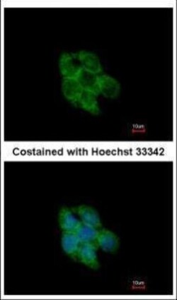 Invitrogen TXNL2 Polyclonal Antibody 100 μL; Unconjugated:Antibodies,