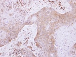 Invitrogen TXNL2 Polyclonal Antibody 100 μL; Unconjugated:Antibodies,
