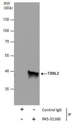 Invitrogen TXNL2 Polyclonal Antibody 100 μL; Unconjugated:Antibodies,