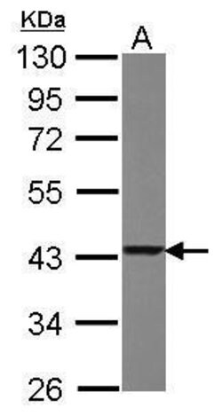 Invitrogen TXNL2 Polyclonal Antibody 100 μL; Unconjugated:Antibodies,