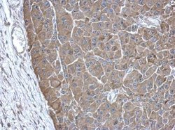 Invitrogen PAICS Polyclonal Antibody 100 &mu;L | Buy Online | Invitrogen&trade; | Fisher Scientific