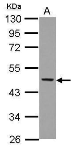 Invitrogen p47phox Polyclonal Antibody 100 &mu;L; Unconjugated:Antibodies,