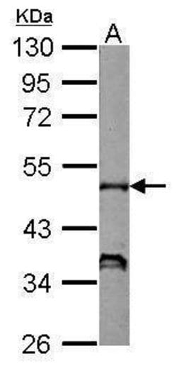 Invitrogen p47phox Polyclonal Antibody 100 &mu;L; Unconjugated:Antibodies,