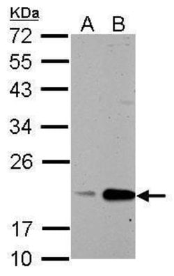 Invitrogen Cyclophilin B Polyclonal Antibody 100 &mu;L; Unconjugated:Antibodies,
