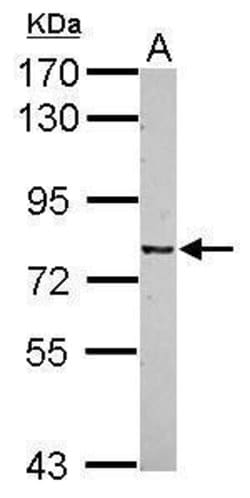 Invitrogen CSRP2BP Polyclonal Antibody 100 μL; Unconjugated:Antibodies,