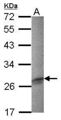 Invitrogen FHL3 Polyclonal Antibody 100 μL; Unconjugated:Antibodies,