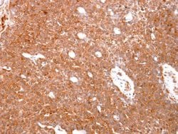 Invitrogen GST Omega 1 140A Polyclonal Antibody 100 &mu;L; Unconjugated:Antibodies,