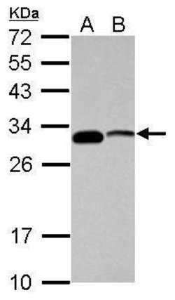 Invitrogen CENPP Polyclonal Antibody 100 &mu;L; Unconjugated:Antibodies,