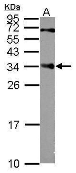 Invitrogen CENPP Polyclonal Antibody 100 &mu;L; Unconjugated:Antibodies,