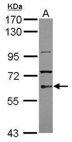 Invitrogen TKTL2 Polyclonal Antibody 100 &mu;L; Unconjugated:Antibodies,