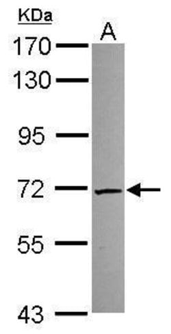 Invitrogen TKTL2 Polyclonal Antibody 100 &mu;L; Unconjugated:Antibodies,