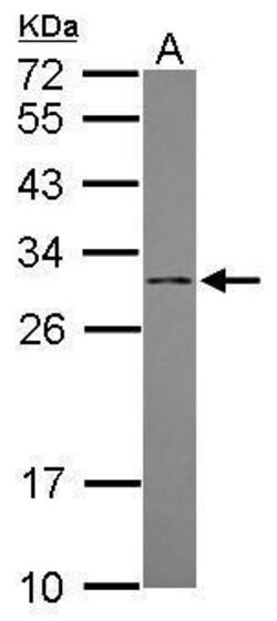Invitrogen DCI Polyclonal Antibody 100 &mu;L; Unconjugated:Antibodies,