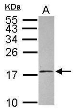 Invitrogen eIF1AY Polyclonal Antibody 100 &mu;L; Unconjugated:Antibodies,
