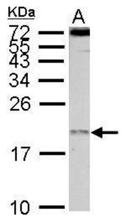 Invitrogen eIF1AY Polyclonal Antibody 100 &mu;L; Unconjugated:Antibodies,