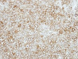 Invitrogen SEMA6C Polyclonal Antibody 100 &mu;L; Unconjugated:Antibodies,